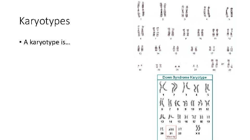 Karyotypes • A karyotype is… 