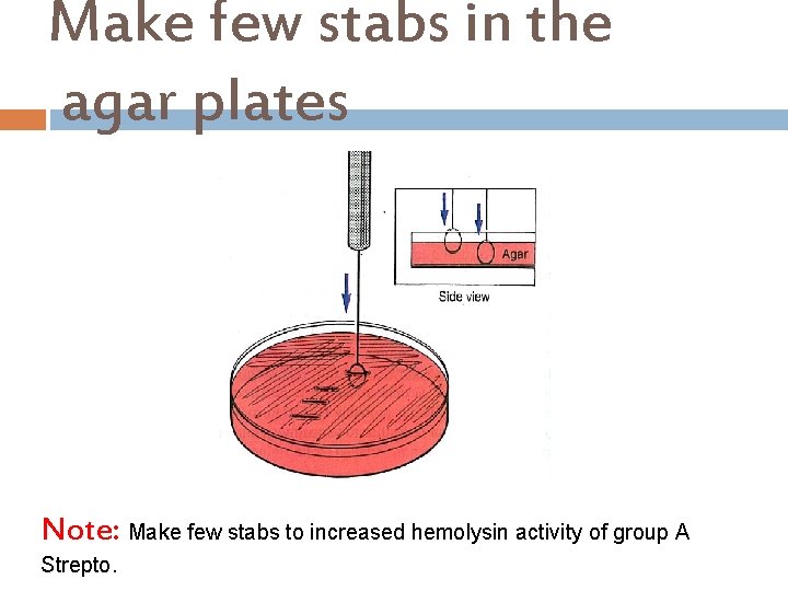 Make few stabs in the agar plates Note: Make few stabs to increased hemolysin