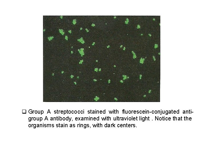 q Group A streptococci stained with fluorescein-conjugated antigroup A antibody, examined with ultraviolet light.