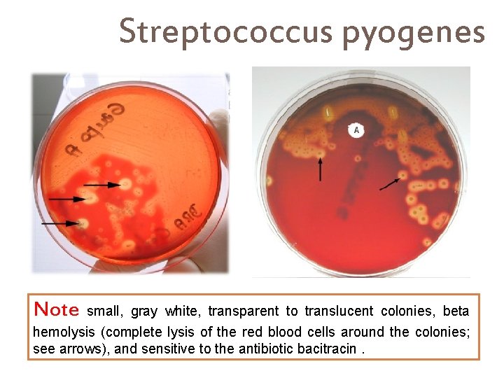 Streptococcus pyogenes Note small, gray white, transparent to translucent colonies, beta hemolysis (complete lysis