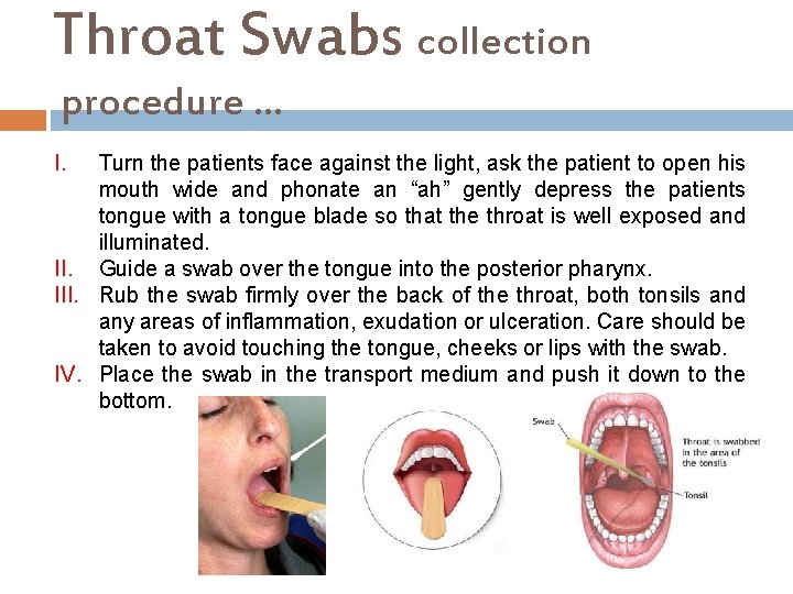 Throat Swabs collection procedure … I. Turn the patients face against the light, ask