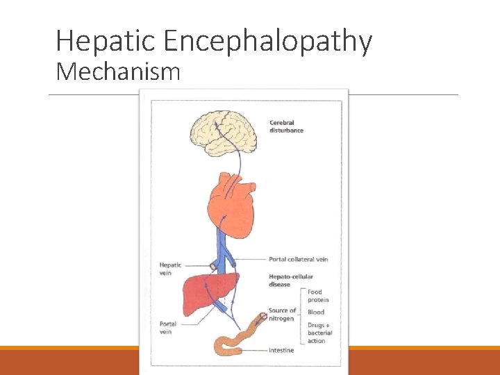 Hepatic Encephalopathy Mechanism 