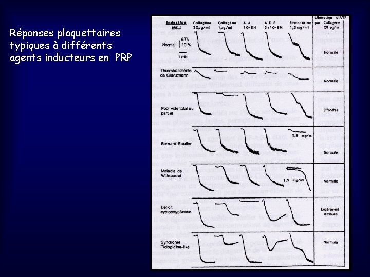 Réponses plaquettaires typiques à différents agents inducteurs en PRP 