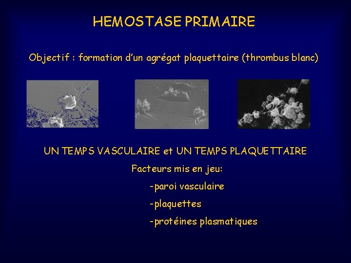 HEMOSTASE PRIMAIRE Objectif : formation d’un agrégat plaquettaire (thrombus blanc) UN TEMPS VASCULAIRE et