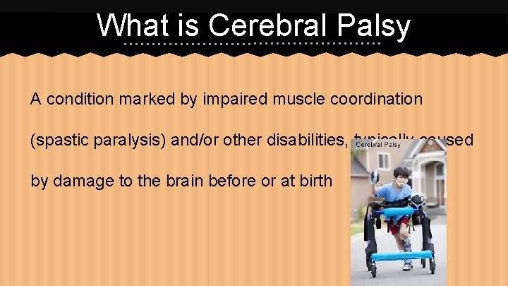 What is Cerebral Palsy A condition marked by impaired muscle coordination (spastic paralysis) and/or