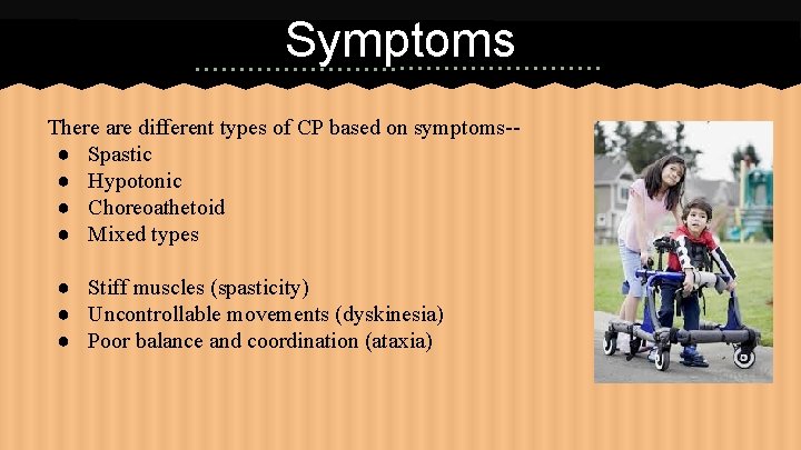 Symptoms There are different types of CP based on symptoms-● Spastic ● Hypotonic ●