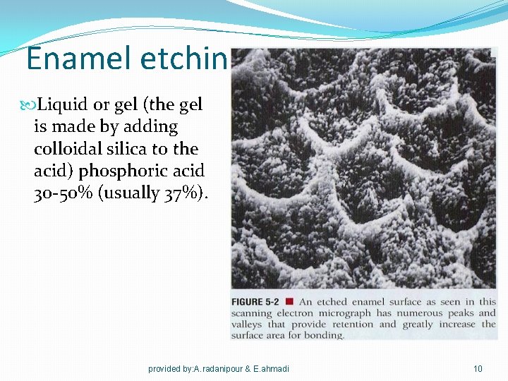 Enamel etching Liquid or gel (the gel is made by adding colloidal silica to