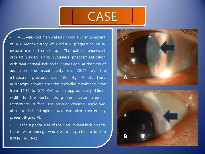 CASE • A 55 -year-old man visited us with a chief complaint of a