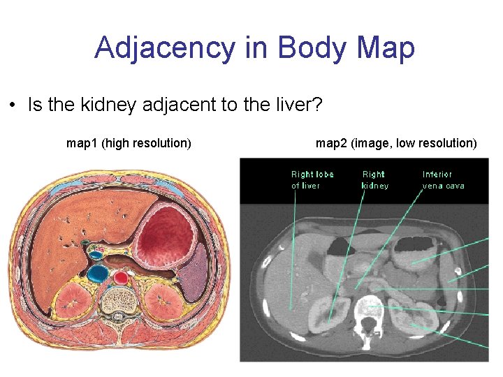 Adjacency in Body Map • Is the kidney adjacent to the liver? map 1