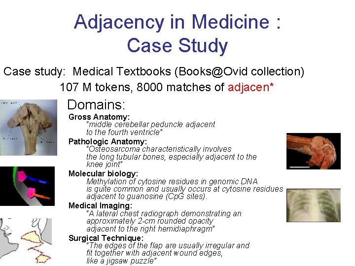 Adjacency in Medicine : Case Study Case study: Medical Textbooks (Books@Ovid collection) 107 M
