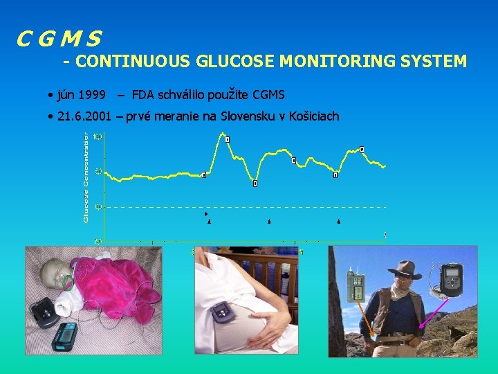 CGMS - CONTINUOUS GLUCOSE MONITORING SYSTEM • jún 1999 – FDA schválilo použite CGMS
