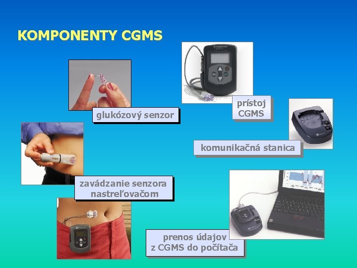 KOMPONENTY CGMS glukózový senzor prístoj CGMS komunikačná stanica zavádzanie senzora nastreľovačom prenos údajov z