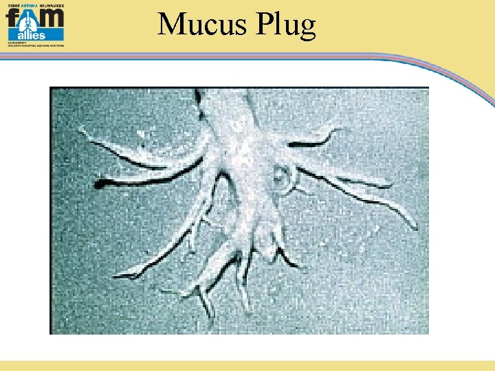 Mucus Plug 