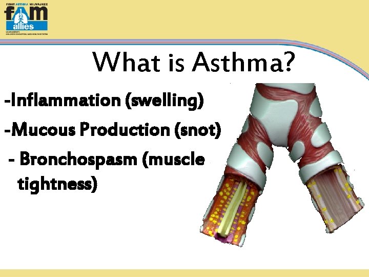 What is Asthma? -Inflammation (swelling) -Mucous Production (snot) - Bronchospasm (muscle tightness) 