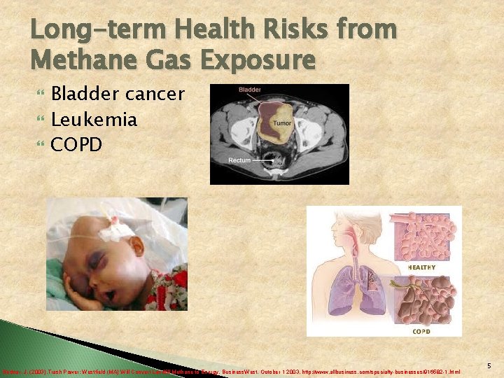 Long-term Health Risks from Methane Gas Exposure Bladder cancer Leukemia COPD Bednar, J. (2003).
