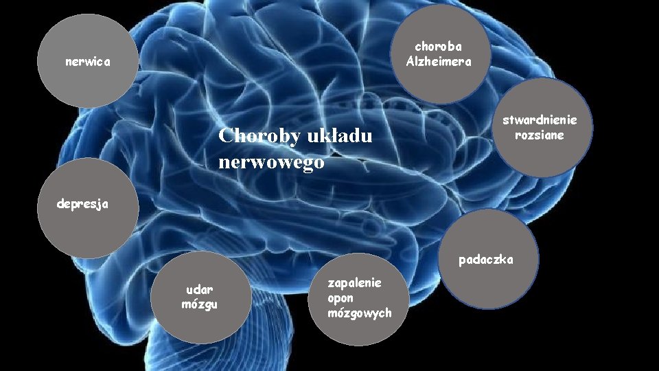 choroba Alzheimera nerwica Choroby układu nerwowego stwardnienie rozsiane depresja padaczka udar mózgu zapalenie opon