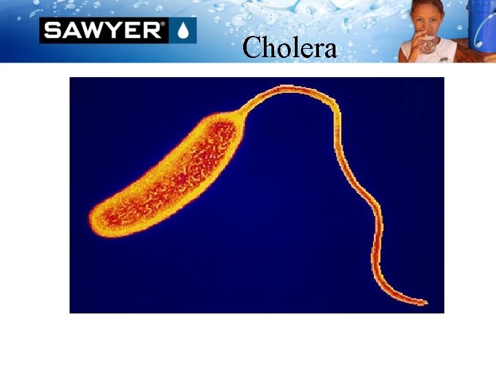 Cholera 