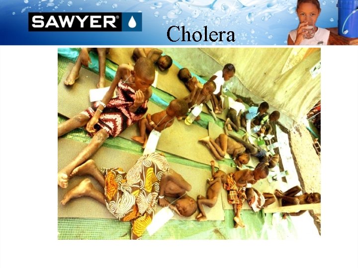 Cholera 