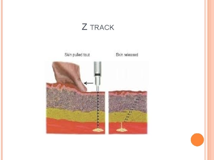 Z TRACK 