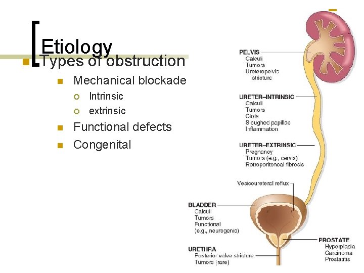 n Etiology Types of obstruction n Mechanical blockade ¡ ¡ n n Intrinsic extrinsic