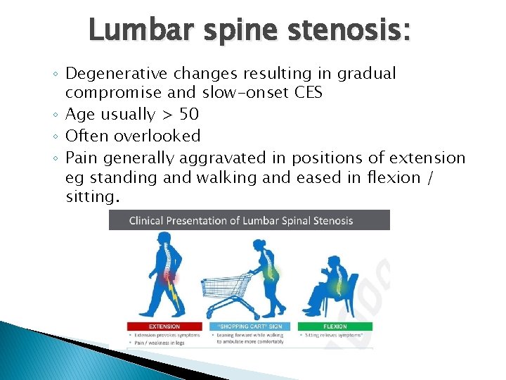 Lumbar spine stenosis: ◦ Degenerative changes resulting in gradual compromise and slow-onset CES ◦
