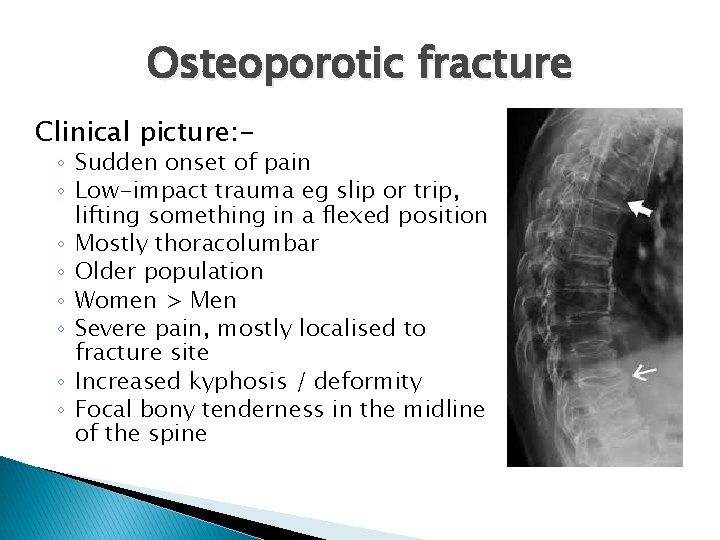 Osteoporotic fracture Clinical picture: - ◦ Sudden onset of pain ◦ Low-impact trauma eg