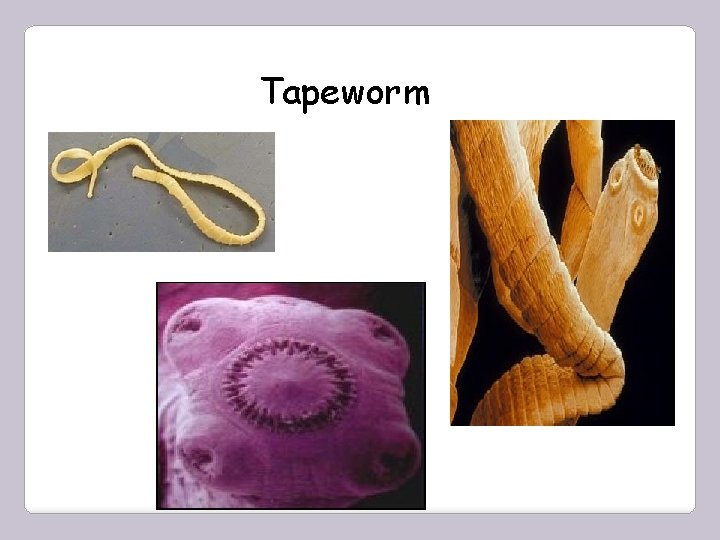Tapeworm 
