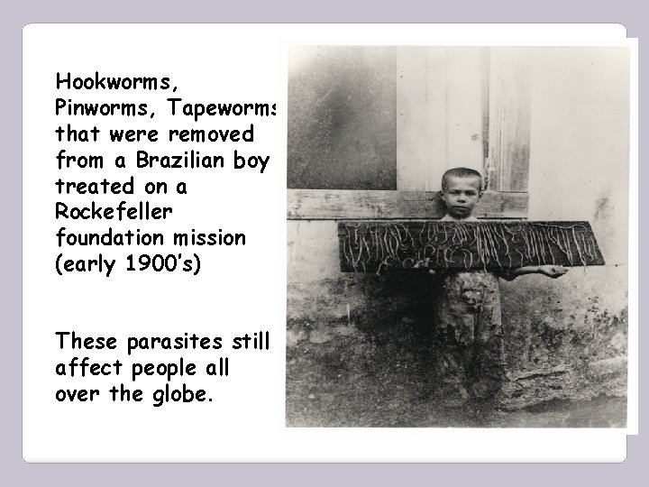 Hookworms, Pinworms, Tapeworms that were removed from a Brazilian boy treated on a Rockefeller