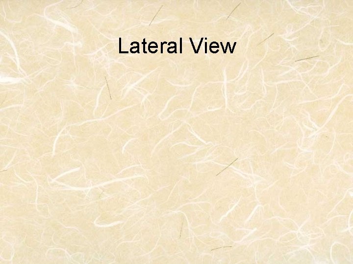 Lateral View 