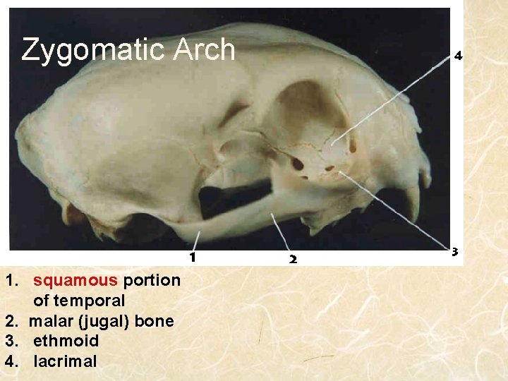 Zygomatic Arch 1. squamous portion of temporal 2. malar (jugal) bone 3. ethmoid 4.