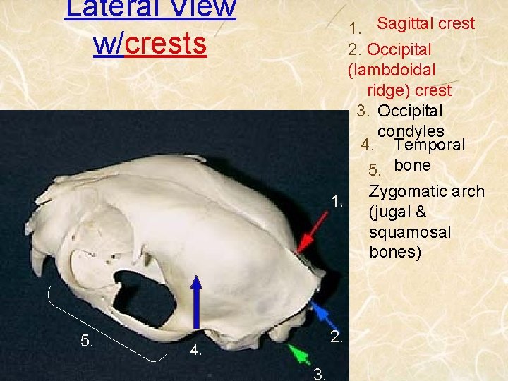 Lateral View w/crests 5. 1. Sagittal crest 2. Occipital (lambdoidal ridge) crest 3. Occipital