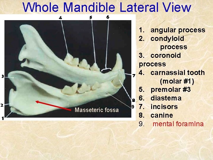 Whole Mandible Lateral View Masseteric fossa 9 1. angular process 2. condyloid process 3.