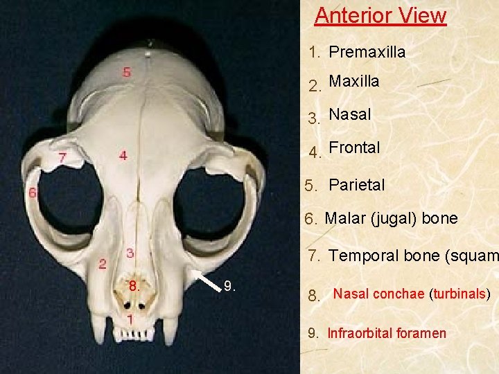 Anterior View 1. Premaxilla 2. Maxilla 3. Nasal 4. Frontal 5. Parietal 6. Malar