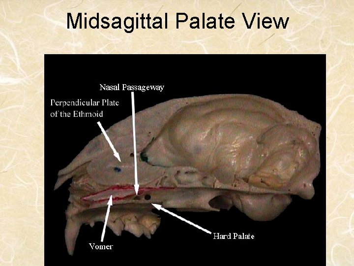 Midsagittal Palate View 