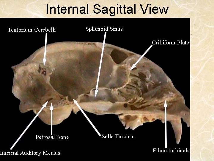 Internal Sagittal View 