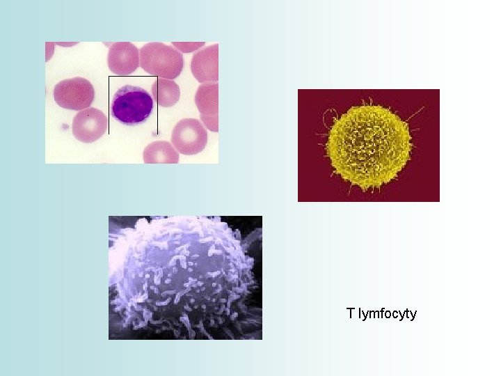 T lymfocyty 