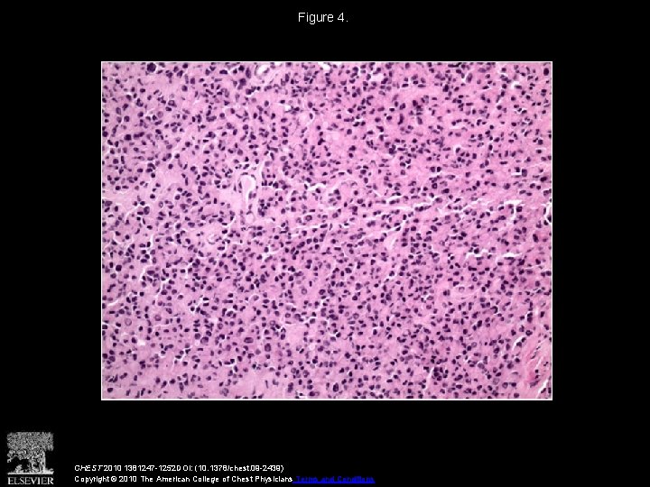 Figure 4. CHEST 2010 1381247 -1252 DOI: (10. 1378/chest. 09 -2439) Copyright © 2010