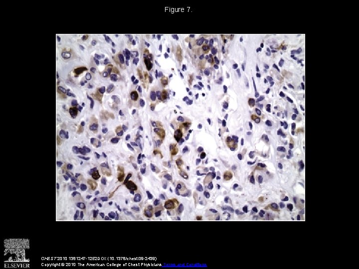 Figure 7. CHEST 2010 1381247 -1252 DOI: (10. 1378/chest. 09 -2439) Copyright © 2010