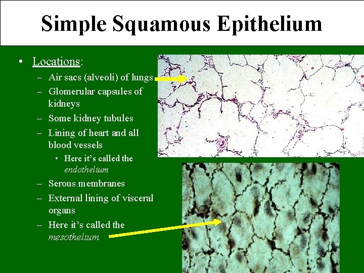 Simple Squamous Epithelium • Locations: – Air sacs (alveoli) of lungs – Glomerular capsules