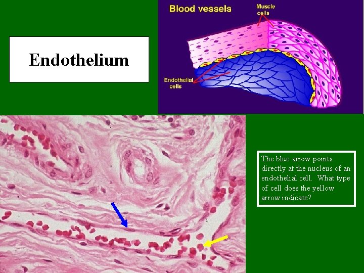Endothelium The blue arrow points directly at the nucleus of an endothelial cell. What