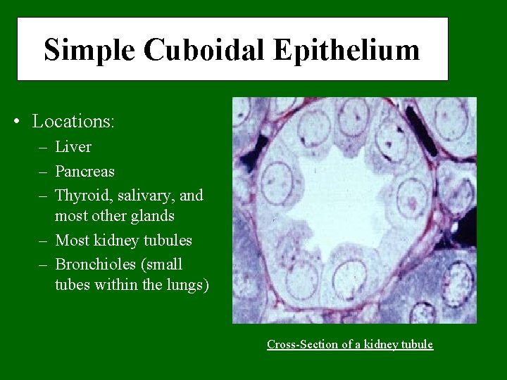 Simple Cuboidal Epithelium • Locations: – Liver – Pancreas – Thyroid, salivary, and most