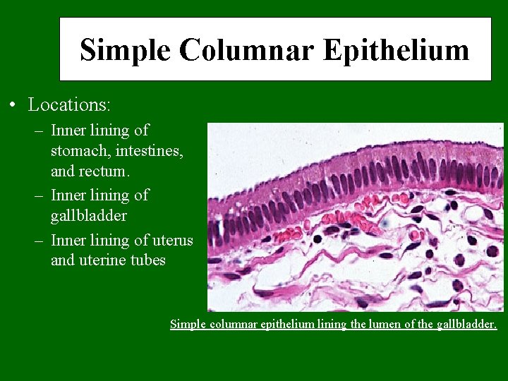 Simple Columnar Epithelium • Locations: – Inner lining of stomach, intestines, and rectum. –