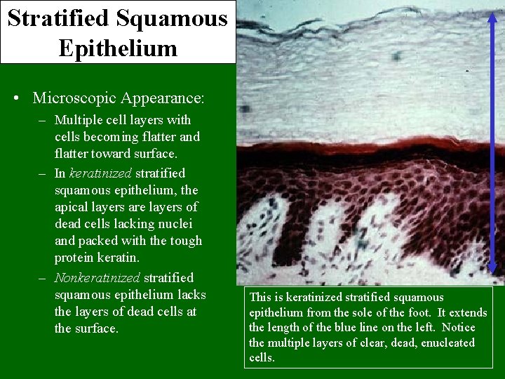 Stratified Squamous Epithelium • Microscopic Appearance: – Multiple cell layers with cells becoming flatter