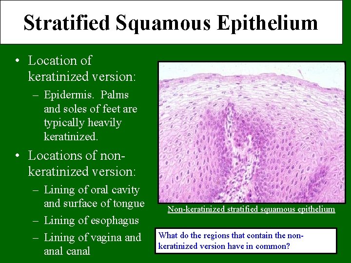 Stratified Squamous Epithelium • Location of keratinized version: – Epidermis. Palms and soles of