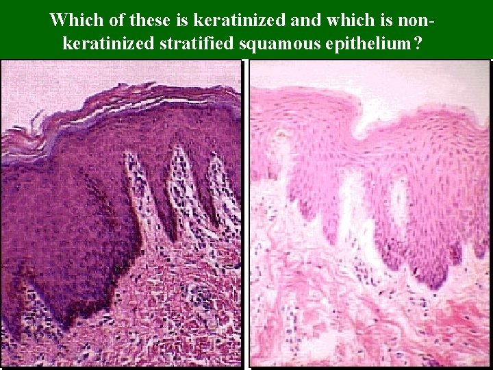 Which of these is keratinized and which is nonkeratinized stratified squamous epithelium? 