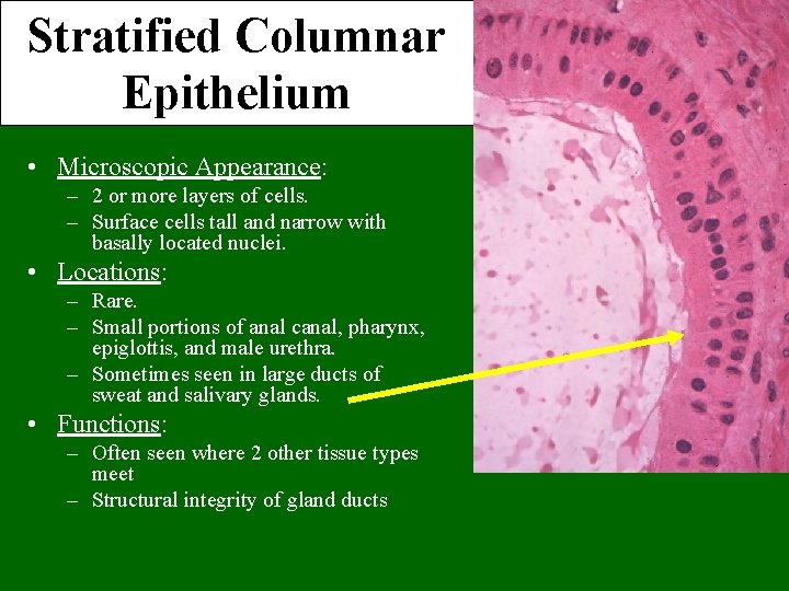 Stratified Columnar Epithelium • Microscopic Appearance: – 2 or more layers of cells. –