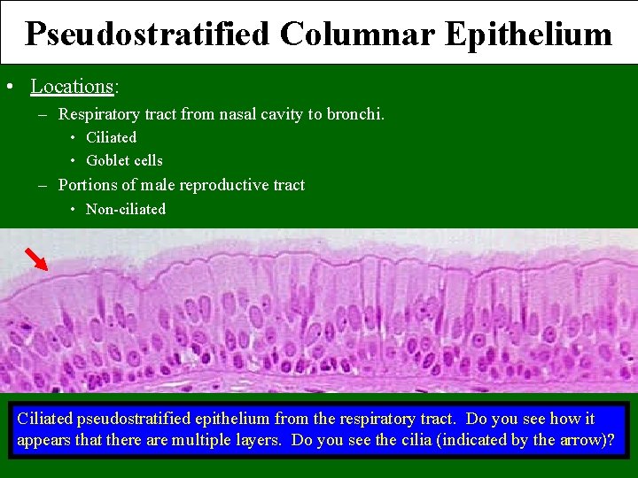 Pseudostratified Columnar Epithelium • Locations: – Respiratory tract from nasal cavity to bronchi. •