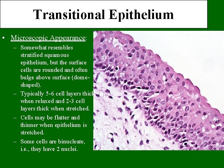 Transitional Epithelium • Microscopic Appearance: – Somewhat resembles stratified squamous epithelium, but the surface