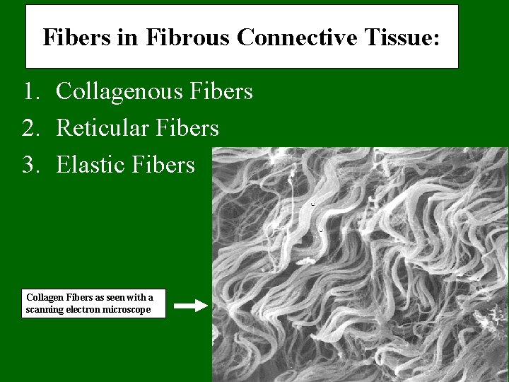 Fibers in Fibrous Connective Tissue: 1. Collagenous Fibers 2. Reticular Fibers 3. Elastic Fibers