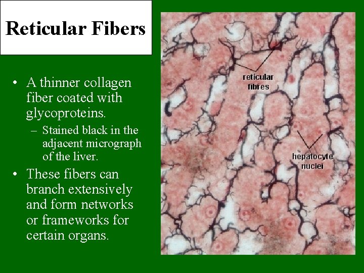 Reticular Fibers • A thinner collagen fiber coated with glycoproteins. – Stained black in